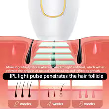 Épilateur laser IPL